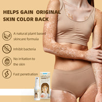 Sumifun Vitiligo Skin Care Spray 20ml | Botanical Skin Care Mist | Even Tone Skin Care Formula | External Use Skin Spray