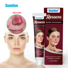 Sumifun Redness Relief Face Cream 30g | Soothing Facial Moisturizing Cream | Daily Skin Care Cream for Sensitive Skin