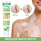 Sumifun Vitiligo Care Cream 20g | Botanical Skin Care Cream | Daily Skin Moisturizing Formula | External Use Cream