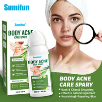Sumifun Body Acne Care Spray 100ml | Tea Tree Body Spray | Back, Chest & Shoulder Skin Care Spray | Daily Body Care Formula