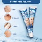 Sumifun Warts Remover Antibacterial Cream Skin Tag Removal Oil Wart Treatment