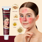 Sumifun Redness Relief Face Cream 30g | Soothing Facial Moisturizing Cream | Daily Skin Care Cream for Sensitive Skin