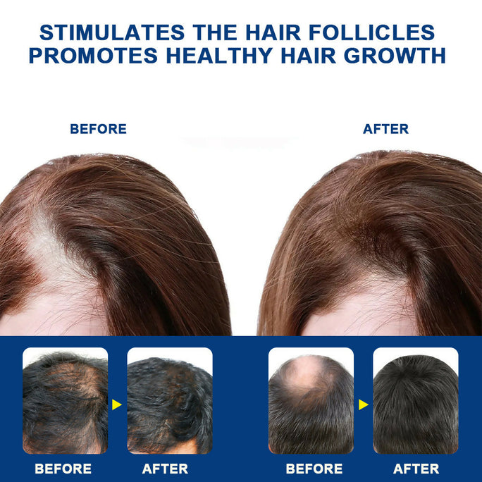 Sumifun Alopecia Hair Care Cream 20g | Botanical Scalp Care Cream | Hair Nourishing Formula | Daily External Use