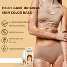 Sumifun Vitiligo Care Cream 30ml | Pigmentation Care Cream | Botanical Skin Care Formula | Daily Skin Care | External Use