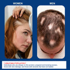 Sumifun Alopecia Hair Care Cream 20g | Botanical Scalp Care Cream | Hair Nourishing Formula | Daily External Use