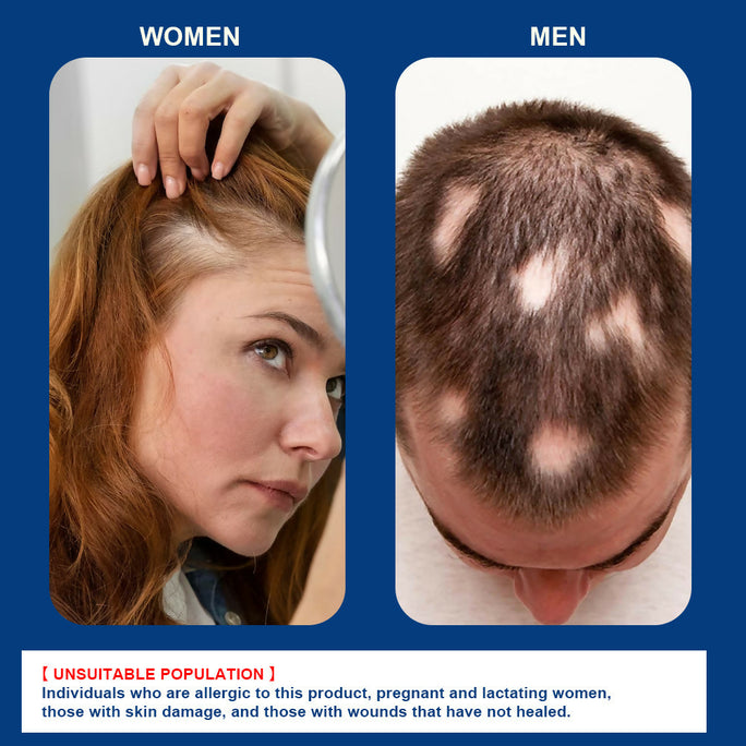 Sumifun Alopecia Hair Care Cream 20g | Botanical Scalp Care Cream | Hair Nourishing Formula | Daily External Use