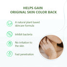 Sumifun Vitiligo Care Cream 20g | Botanical Skin Care Cream | Daily Skin Moisturizing Formula | External Use Cream