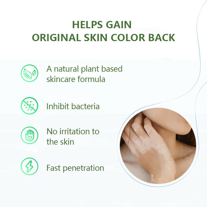 Sumifun Vitiligo Care Cream 20g | Botanical Skin Care Cream | Daily Skin Moisturizing Formula | External Use Cream