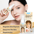 Sumifun Vitiligo Care Cream 30ml | Pigmentation Care Cream | Botanical Skin Care Formula | Daily Skin Care | External Use