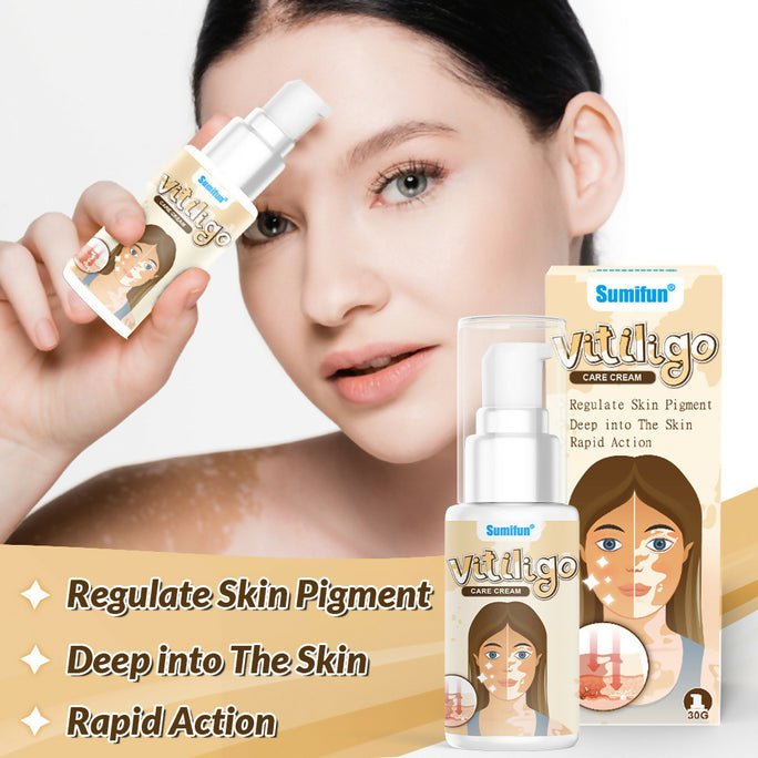 Sumifun Vitiligo Care Cream 30ml | Pigmentation Care Cream | Botanical Skin Care Formula | Daily Skin Care | External Use
