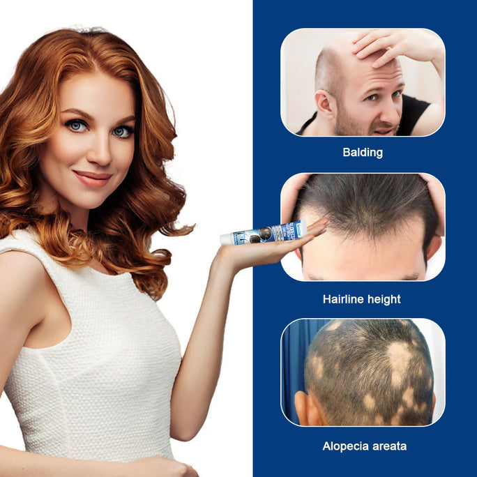 Sumifun Alopecia Hair Care Cream 20g | Botanical Scalp Care Cream | Hair Nourishing Formula | Daily External Use