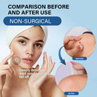 Sumifun Warts Remover Antibacterial Cream Skin Tag Removal Oil Wart Treatment