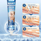 Sumifun Warts Remover Antibacterial Cream Skin Tag Removal Oil Wart Treatment
