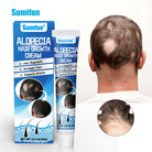 Sumifun Alopecia Hair Care Cream 20g | Botanical Scalp Care Cream | Hair Nourishing Formula | Daily External Use
