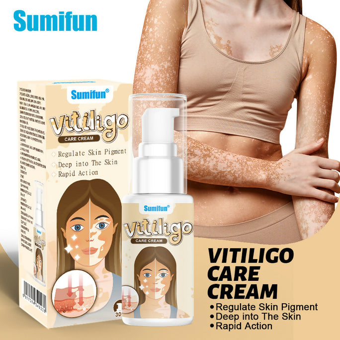 Sumifun Vitiligo Care Cream 30ml | Pigmentation Care Cream | Botanical Skin Care Formula | Daily Skin Care | External Use